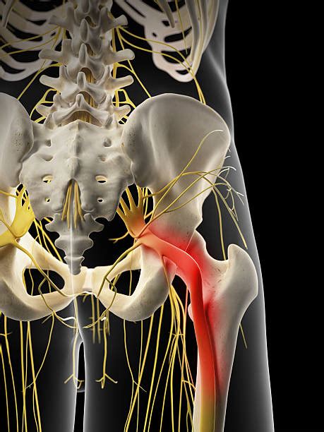 Fotografii de stoc cu Nervul Sciatic